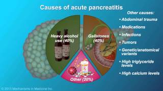 Acute Pancreatitis [upl. by Cinimmod]