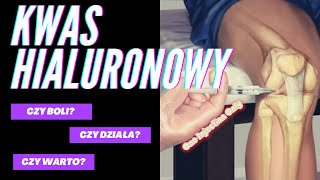 Kwas Hialuronowy moje doświadczenia Czy boli Czy warto [upl. by Aguayo]