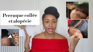 LE DANGER DES PERRUQUES COLLÉES  ALOPECIE  CHEVEUXAFRO [upl. by Ann-Marie]