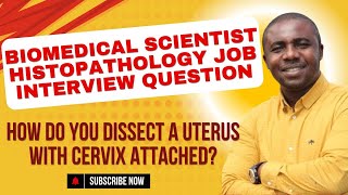 HOW DO YOU DISSECT A UTERUS WITH CERVIX ATTACHED [upl. by Fromma356]