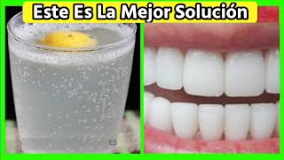 Quita el Sarro de Tus Dientes con 1 Remedio casero hecho por ti mismo [upl. by Aima176]