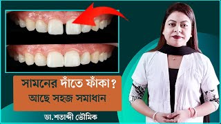 সামনের দাঁতে ফাঁকা  Gap Between Front teeth  Dr Shatabdi Bhowmik  Bangla [upl. by Margette]