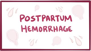 Postpartum hemorrhage  causes symptoms diagnosis treatment pathology [upl. by Niarda]