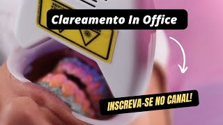 Clareamento dental em Consultório com uso de Potenza Bianco gelLedLaser [upl. by Ardekahs]