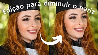 RINOPLASTIA COM APLICATIVO 👃 [upl. by Vaclava721]