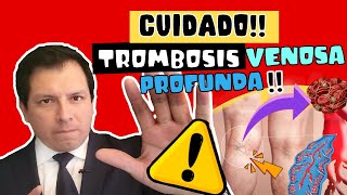 CUIDADO ⚠️ TROMBOSIS VENOSA PROFUNDA  SÍNTOMAS Y COMPLICACIONES 😱😱😱 [upl. by Trella]