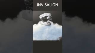 Invisalign Underbite  Time Lapse  London UK [upl. by Derian]