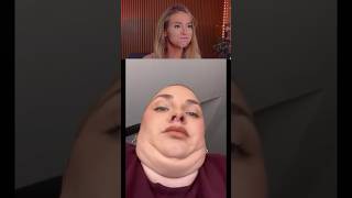 Try Not To Laugh Challenge 485 🤣 funny shorts viral [upl. by Atinej837]