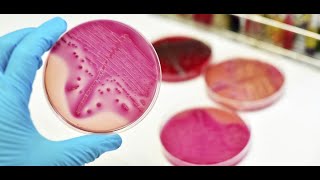 Morphology of Mycobacterium Avium Infectious Complex [upl. by Viviene821]