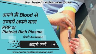 पीआरपी थेरेपी क्या है   PRP HAIR LOSS TREATMENT IN HINDI  PRP THERAPY [upl. by Akinuahs]