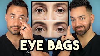 How Treat Under Eye Bags Like A Dermatologist [upl. by Kotick]