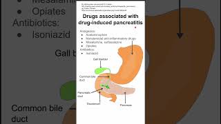 Drugs associated with druginduced pancreatitis [upl. by Cohbath]