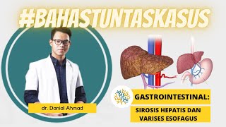 SINAPINTAR 16  Gastrointestinal  Sirosis Hepatis dan Varises Esofagus [upl. by Ativla217]