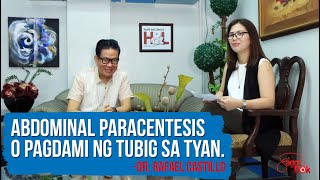 Abdominal Paracentesis o Pagdami ng Tubig sa Tyan  Dr Rafael Castillo [upl. by Akeenat780]