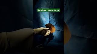 Lumbar puncture lumbarpuncture lumbarpunctureprocedure TechhealthOT [upl. by Kelbee]