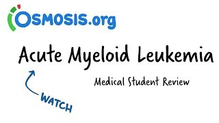 Acute Myeloid Leukemia  Clinical Presentation [upl. by Areis755]