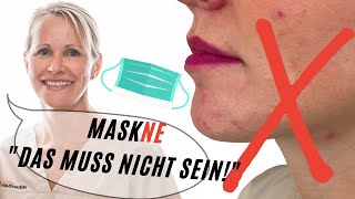 Mundschutz Unreine Haut und Akne MASKNE Das hilft Dr Kasten Hautmedizin in Mainz [upl. by Kippy549]