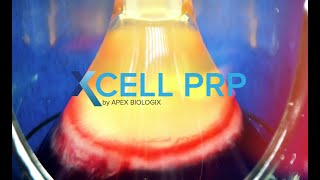 APEX Biologix PRP System [upl. by Goodrow]