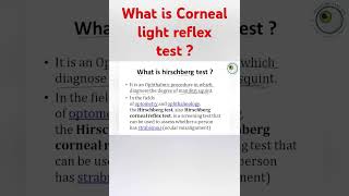 hirschberg corneal reflex test  corneal light reflex test  interpretation of hirschberg test [upl. by Cila613]