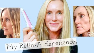 My 3 year Experience with RetinA  Before amp Afters  Tips on how to use Tretinoin wo Irritation [upl. by Melc]