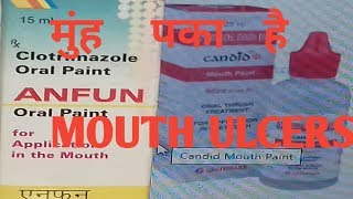 ANFUN ORAL PAINT  CANDID MOUTH PAINT  CLOTRIMAZOLE ORAL PAINT [upl. by Ellerrehc]