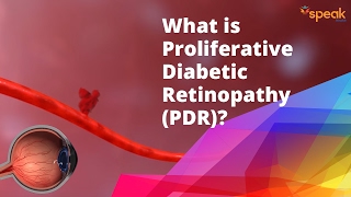 What is Proliferative Diabetic Retinopathy PDR [upl. by Dnesnwot]