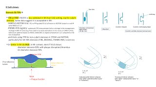 NSTEMI angiographic and PCI tips [upl. by Simaj474]