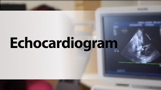 Echocardiogram [upl. by Nohpets848]