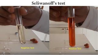 Seliwanoff’s test [upl. by Jolee]