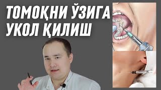 ТОМОҚНИ ТЎҒРИ ЎЗИГА УКОЛ ҚИЛИШ АНГИНАГА УКОЛ ҚИЛИШ ҚАЧОН КИМГА МУМКИН ВА МУМКИН ЭМАС  ИСЧАНОВ [upl. by Zach51]