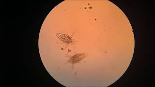 Zooplankton in the Microscope [upl. by Kahaleel]