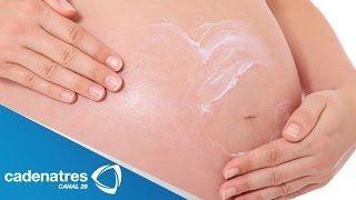 Receta para preparar crema para estrías de mujeres embarazadas Ungüentos para embarazadas [upl. by Rouvin]