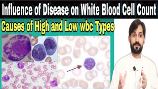 Influence of disease on white blood cell count  Causes of low and high wbc types [upl. by Adelaide]