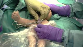 Delayed Cord Clamping [upl. by Aicak395]