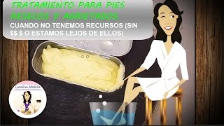 Pies agrietados y resecos Tratamiento y pomadaquotdel campoquot [upl. by Rriocard363]