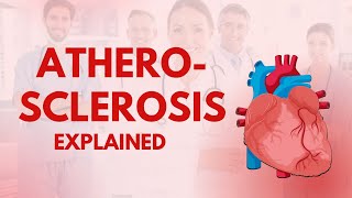 Atherosclerosis Explained [upl. by Aronael]