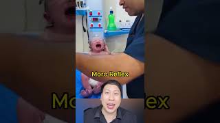 ไม่ได้แกล้งเด็กนะแต่นี่คือ Moro Reflex สาระ facts knowledge เรื่องเล่า funny moro reflex [upl. by Annaujat]