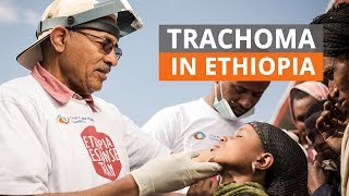 SAFE strategy to fight trachoma in Ethiopia [upl. by Eugen]