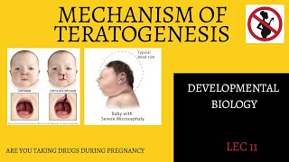 Mechanism of TeratogenesisAbnormal DevelopmentBSMS [upl. by Sualocin]