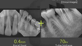 Portable XrayWe focus on Image Quality [upl. by Coady]