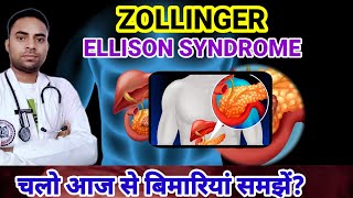 Whats Zollinger Ellison Syndrome ZES DISEASE  SYMPTOMS OF ZES  DISEASES [upl. by Anadroj]