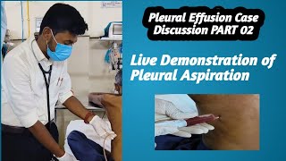 Pleural EffusionCase Discussion PART 02 Pleural Aspiration live Demonstration [upl. by Yesnikcm171]