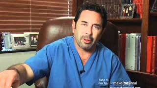 Dr Paul Nassif discusses the swelling and bruising after a blepharoplasty [upl. by Sherlocke832]