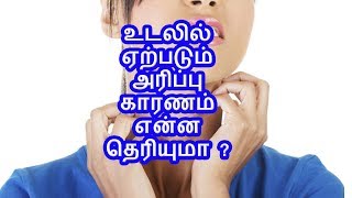 உடலில் ஏற்படும் அரிப்பு காரணம் என்ன தெரியுமா [upl. by Rez]