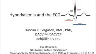 Hyperkalemia and the ECG [upl. by Mersey451]