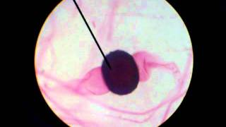 RHIZOPUS STOLONIFER SHOWING ZYGOSPORES [upl. by Ahsoet377]