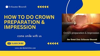 How to do crown preparation amp impression [upl. by Anileh]