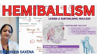 Hemiballism Basal Ganglia disease lesion of subthalamic nuclei [upl. by Zollie]