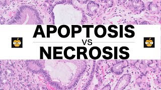 Apoptosis Intrinsic Extrinsic Pathways vs Necrosis [upl. by Filomena]