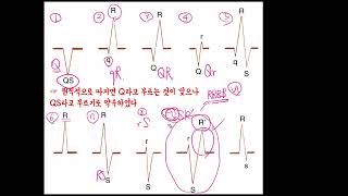 QRS interval의 의미 기역의 기본 심전도 8강 [upl. by Jacquette]